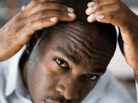 Advice on hair problems