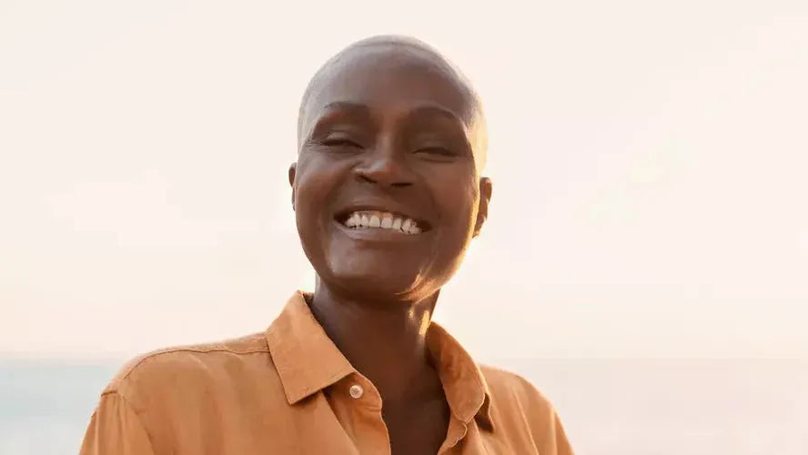 Alopecia totalis: complete hair loss