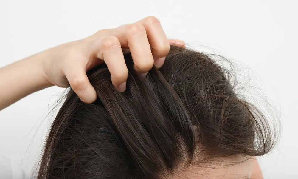 Cierpisz na łuszczycę skóry głowy? Poznaj przyczyny i rozwiązania