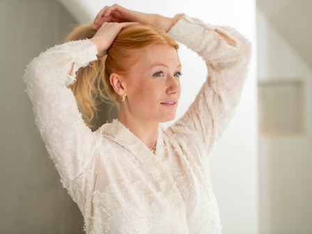 Traction alopecia: hair loss caused by tightly styled hairstyles