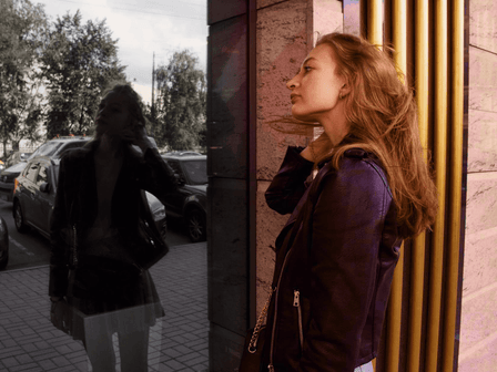 Transsukupuolinen nainen, jolla on hiustenlähtö? Mitkä ovat vaihtoehdot