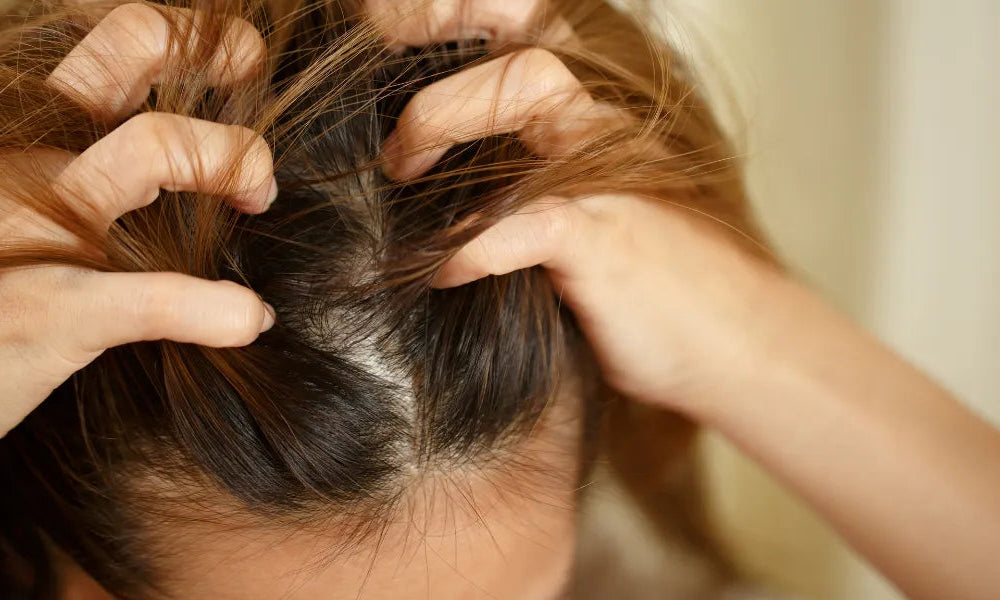 O que fazer com as crostas no couro cabeludo?