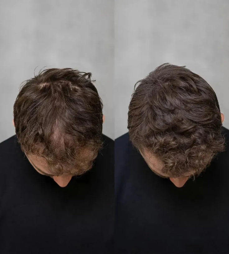 3x Keratain hair fibers + free Keratain pomade – Black (25 gr) - Hairgivers