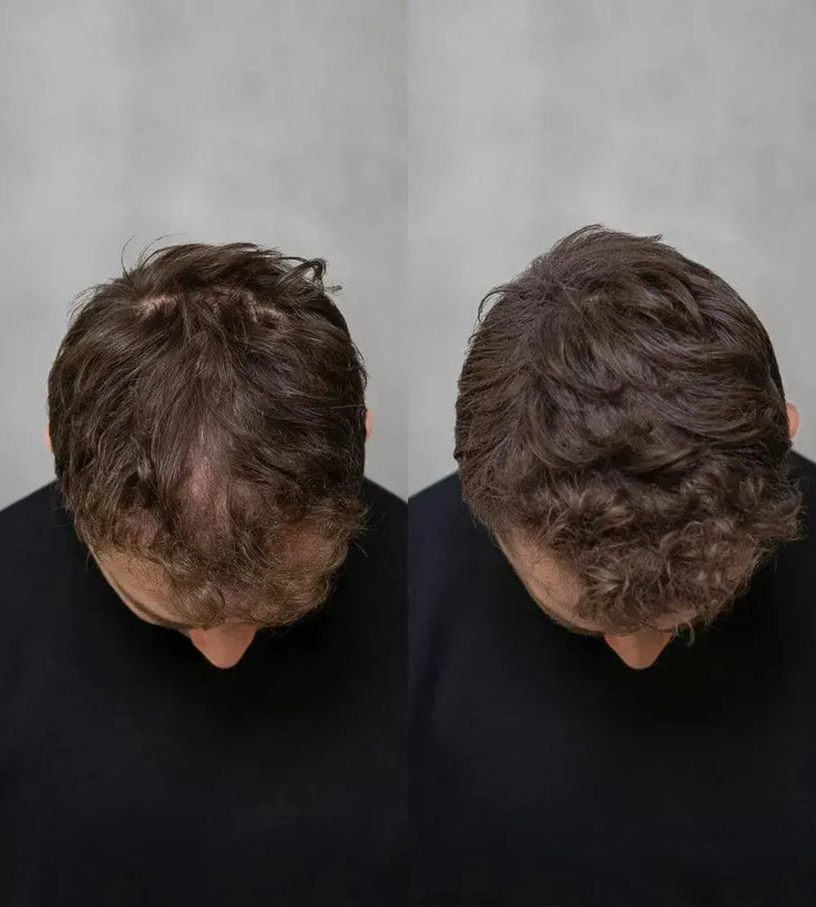 3x Keratain hair fibers + free Keratain pomade – Gray (25 gr) - Hairgivers