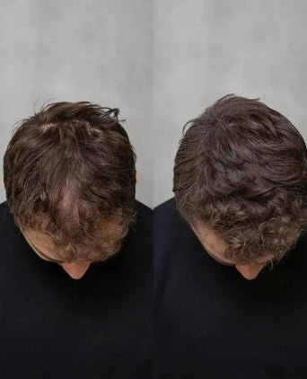 3x Keratain hårfibre + gratis Keratain pomade - Medium brun (25 gr) 3x Keratain hair fibers + free Keratain pomade – Medium brown (25 gr) - Hairgivers