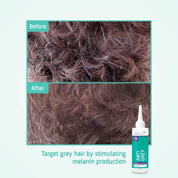 Neofollics anti-grey seerumi Neofollics anti-grey serum - Hairgivers