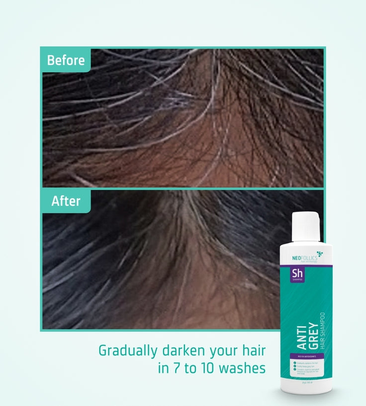 Neofollics anti-grå shampoo