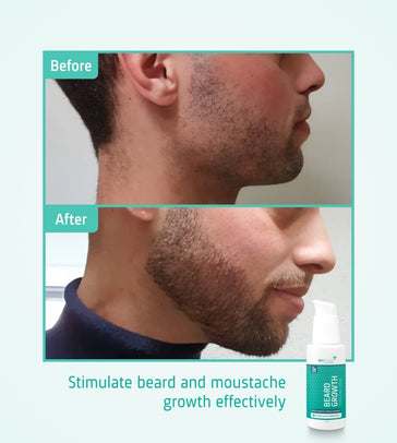 Neofollics beard growth serum 3-pack (7% Neoxyl) Neofollics beard growth serum 3-pack (7% Neoxyl) - Hairgivers