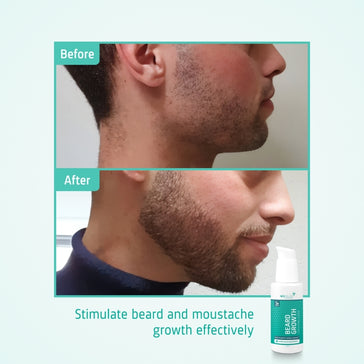 Neofollics serum for skjeggvekst Neofollics beard growth serum (7% Neoxyl) - Hairgivers