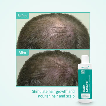 Acondicionador anticaída Neofollics (250 ml) Neofollics conditioner (250 ml) - Hairgivers