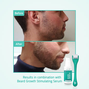 4x Neofollics suero para el crecimiento de la barba + rodillo para barba de regalo 4x Neofollics beard growth serum + free beard roller - Hairgivers