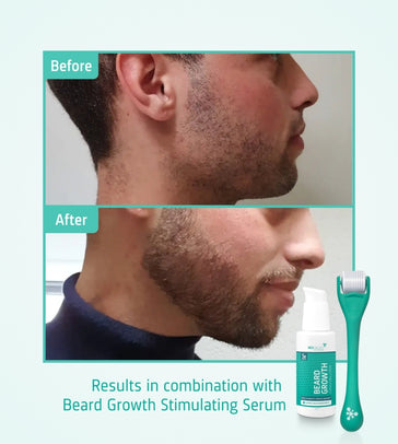 4x serum na porost brody Neofollics + darmowy wałek do brody 4x Neofollics beard growth serum + free beard roller - Hairgivers