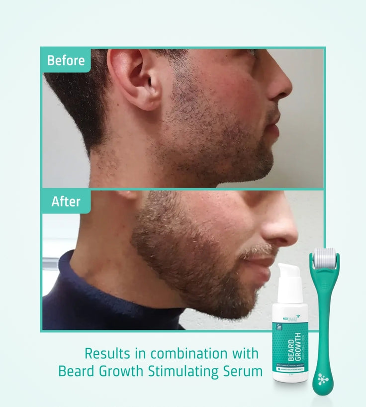 4x Neofollics suero para el crecimiento de la barba + rodillo para barba de regalo