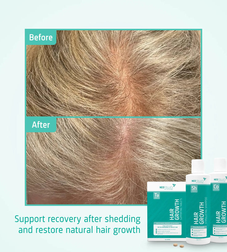 Neofollics Shampoo + Balsamo + Compresse