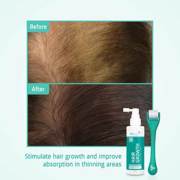 4x Neofollics lotion + gratis hodebunnsrulle 4x Neofollics lotion + free scalp roller - Hairgivers