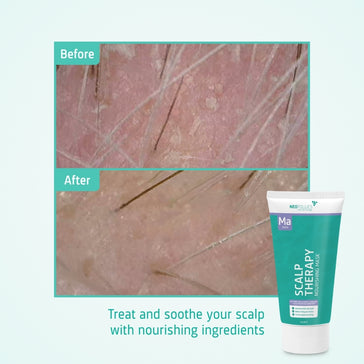 Neofollics ravitseva naamio Neofollics nourishing mask - Hairgivers