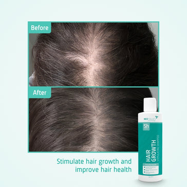 Neofollics hair growth shampoo (250 ml) Neofollics hair growth shampoo (250 ml) - Hairgivers