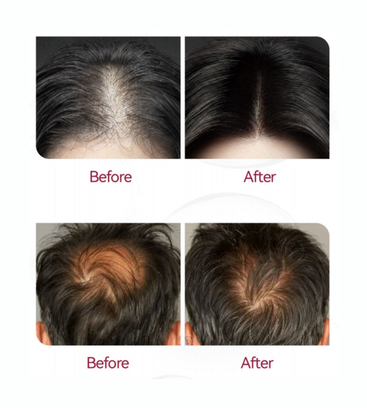 Beaver Shampoo anti-caduta + Siero + Applicatore