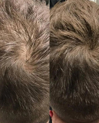 Beaver keratin hair building fibers - Dark brown (28 gr) Beaver keratin hair building fibers - Dark brown (28 gr) - Hairgivers