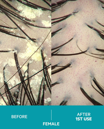 Dandrene schampo mot mjäll Dandrene schampo mot mjäll