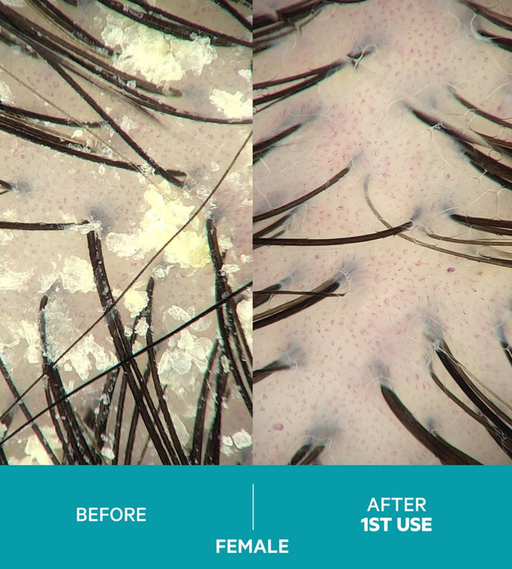 Szampon przeciwłupieżowy Dandrene