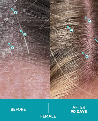 Dandrene schampo mot mjäll Dandrene schampo mot mjäll