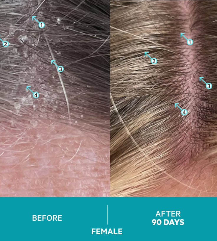 Szampon przeciwłupieżowy Dandrene