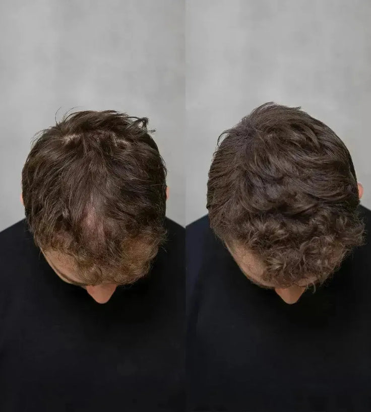 Keratain pomade + Keratain hair fibers – Light brown (25 gr) - Hairgivers