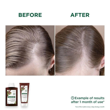 Shampoo + balsamo anti-caduta Klorane Klorane anti-hair loss shampoo + conditioner - Hair Growth Specialist