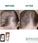 Klorane anti-hair loss shampoo + conditioner - Hairgivers