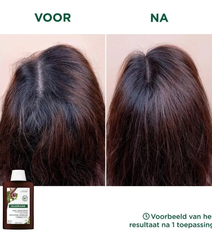 Klorane anti-hair loss shampoo Quinine/Edelweiss (400 ml) - Hairgivers