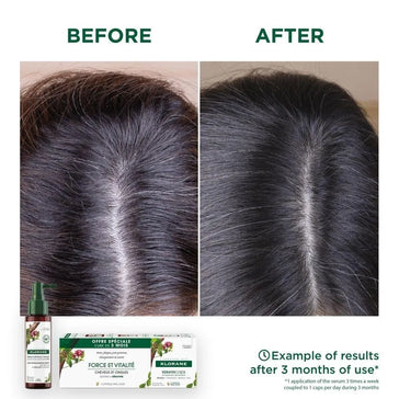Klorane behandling mot håravfall Klorane anti-hair loss treatment - Hair Growth Specialist