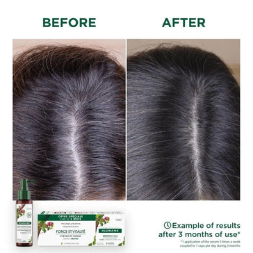 Trattamento anticaduta Klorane Klorane anti-hair loss treatment - Hairgivers