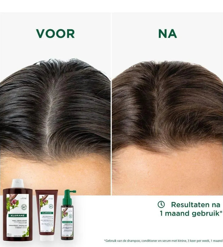 Klorane anti-hair loss treatment - Hairgivers