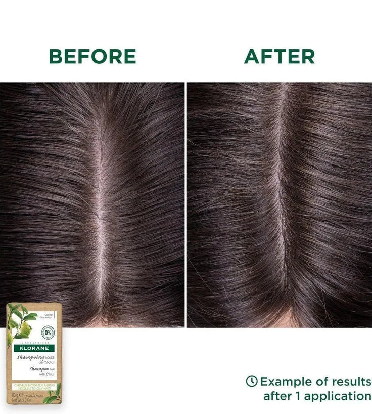 Klorane shampoo bar Citrus - oily hair (80 gr) - Hairgivers