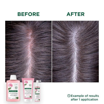 Klorane-behandling för känslig hårbotten Klorane treatment for sensitive scalp - Hair Growth Specialist