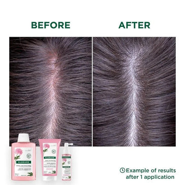 Traitement Klorane pour cuir chevelu sensible Klorane treatment for sensitive scalp - Hairgivers