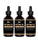Mzel Batana oil 3-pack (3x60 ml) - Hairgivers