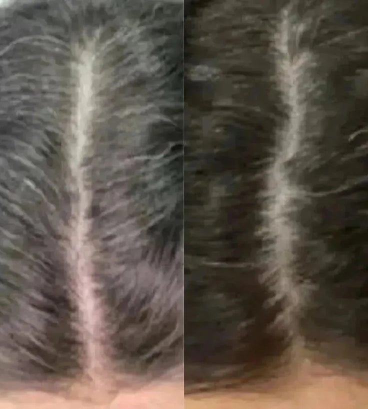 Neofollics anti-grey hair tablets (3-pack) - Hairgivers