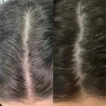 Neofollics tabletter mot grått hår Neofollics anti-grey hair tablets - Hairgivers