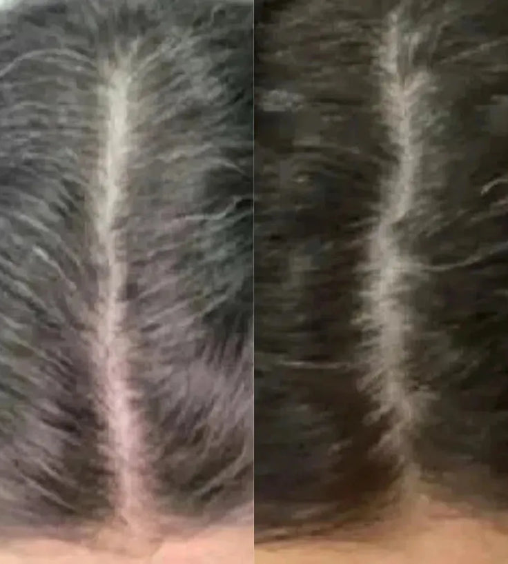 Neofollics anti-grey hair tablets - Hairgivers