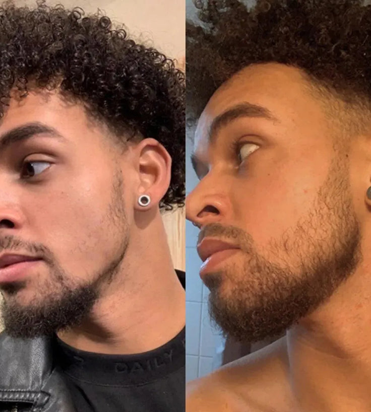 Neofollics beard growth serum (7% Neoxyl) - Hairgivers