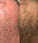 Panthrix hair growth serum 3-pack (Redensyl) - Hairgivers