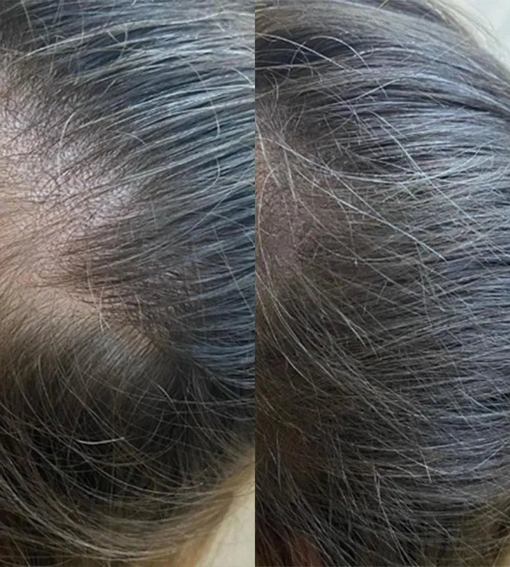 Panthrix hair growth serum (Redensyl) - Hairgivers