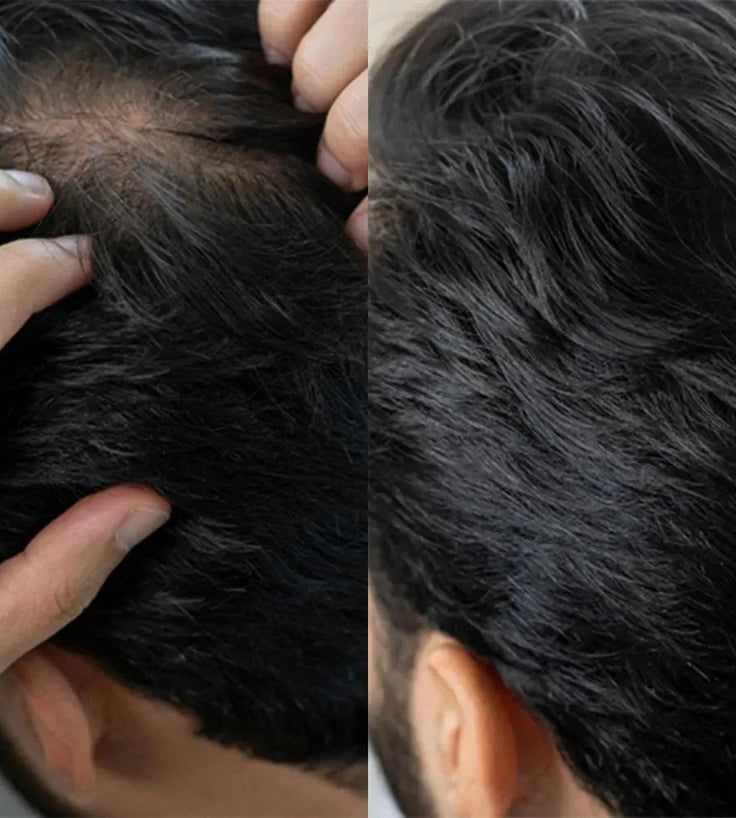 Panthrix hair growth serum (Redensyl) - Hairgivers