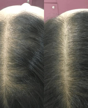 Acondicionador Revita (925 ml) Acondicionador Revita (925 ml)