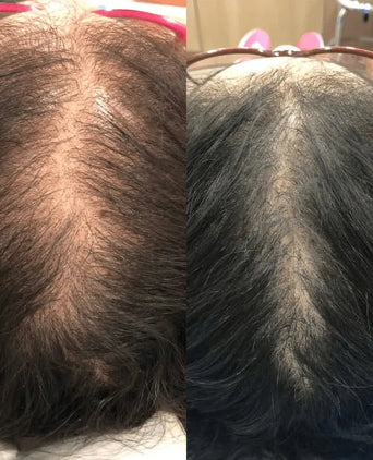 Revita hair growth shampoo + conditioner (925 ml) Revita hair growth shampoo + conditioner (925 ml)