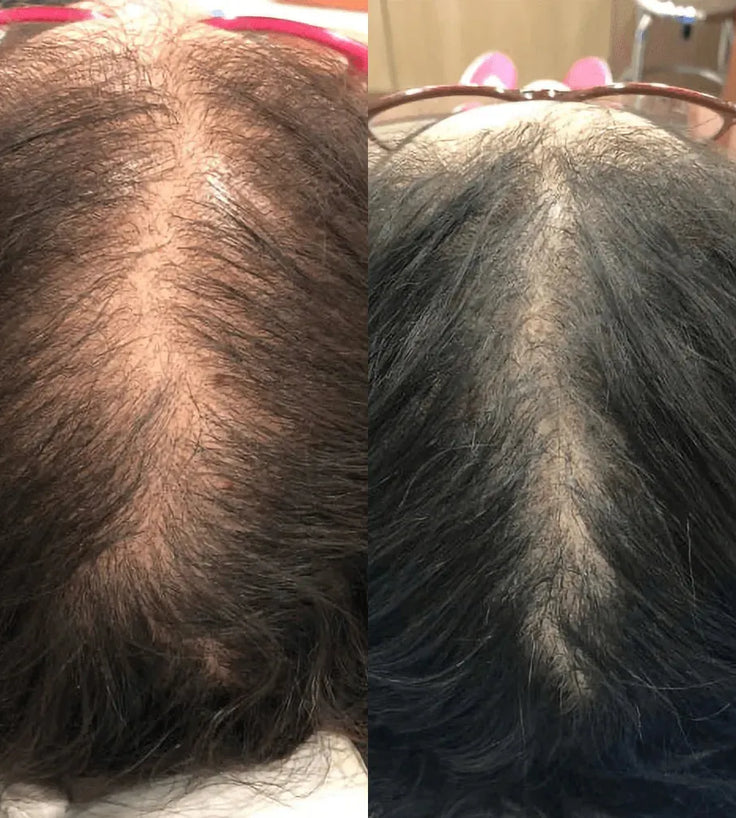 Revita hair growth shampoo + conditioner (925 ml) - Hairgivers