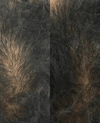 Revita comprimidos para o crescimento do cabelo (1 mês) Revita tablets for hair growth (1 month) - Hairgivers