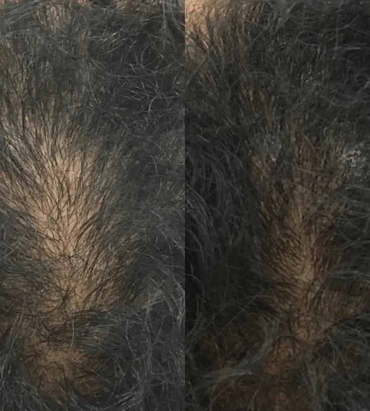 Revita tablets for hair growth (1 month) - Hairgivers